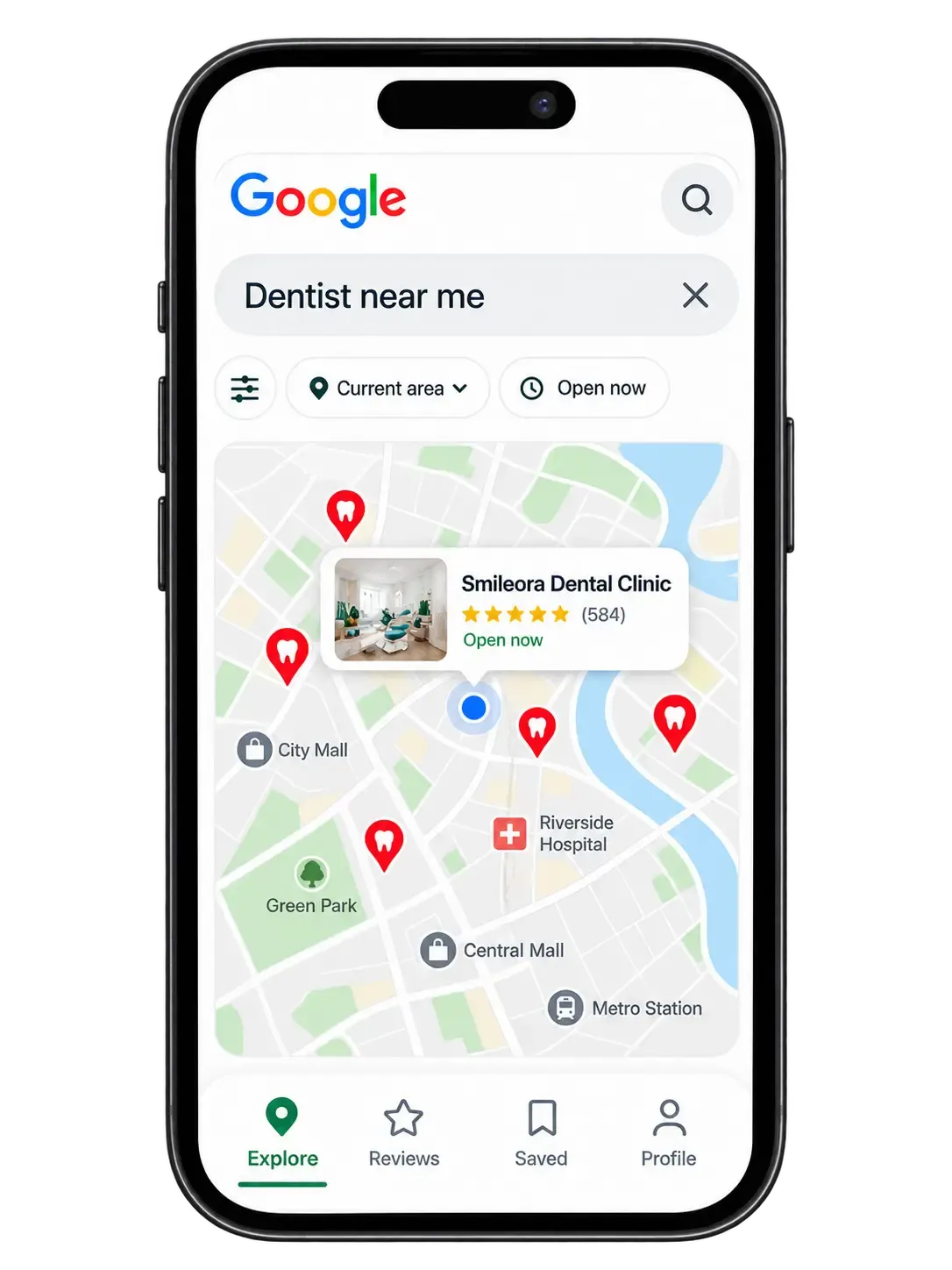 Phone showing a map search for dentist near me